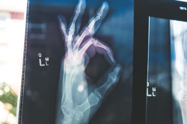 Radio de la main assurée